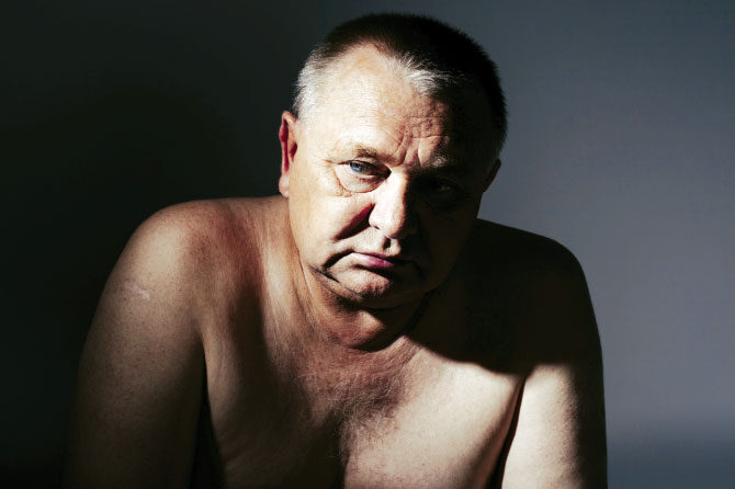 Ko se pojavijo težave z uriniranjem