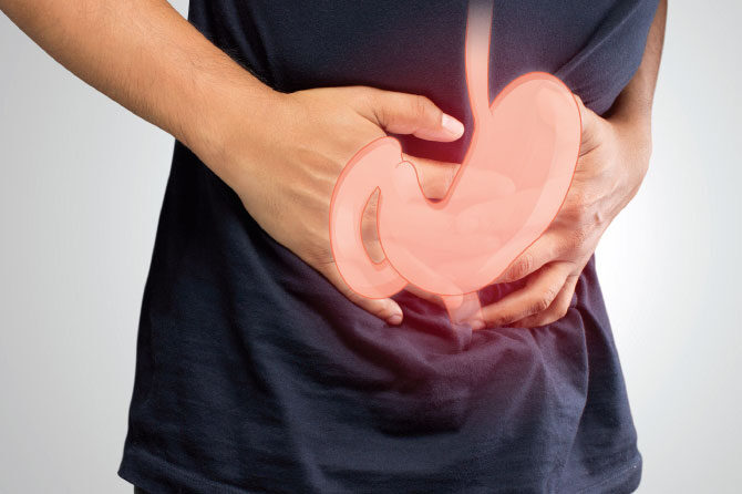 Razjeda želodca in dvanajstnika ter refluksna bolezen požiralnika