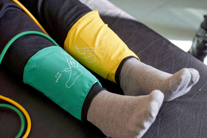 Novosti pri zdravljenju periferne arterijske bolezni