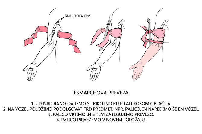 Kanček nerodnosti in poškodba je tu