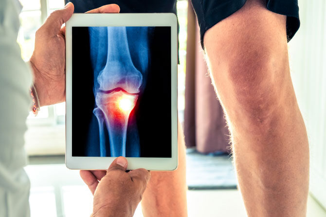 Glavno orožje v naših rokah je gibanje