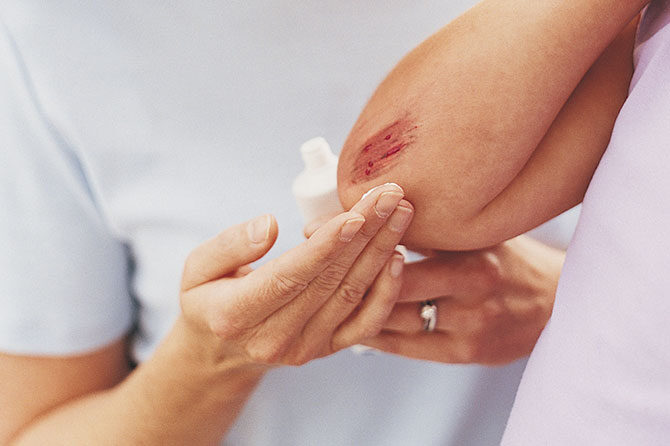 Ne gre za nerodnost, vsakemu se lahko zgodi