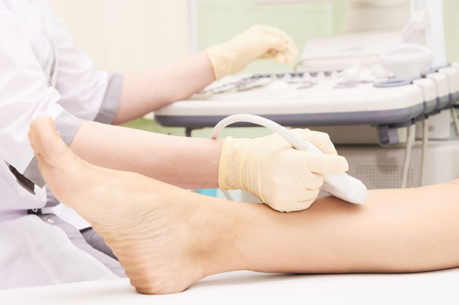 Flebološki pregled in ultrazvok ven spodnjih okončin