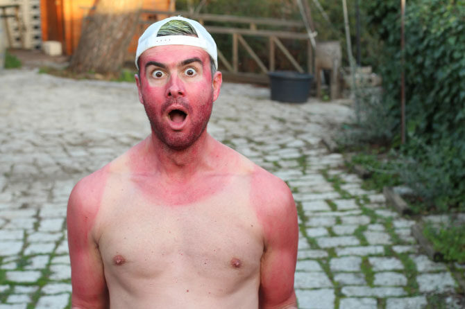 Boj proti kožnemu raku – Poglejte gor