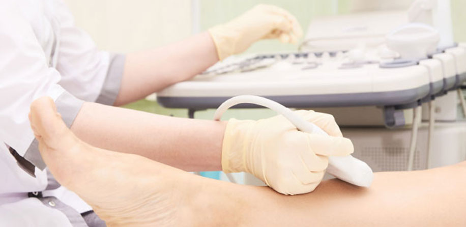 Flebološka dejavnost – obravnava bolezni povrhnjih ven nog