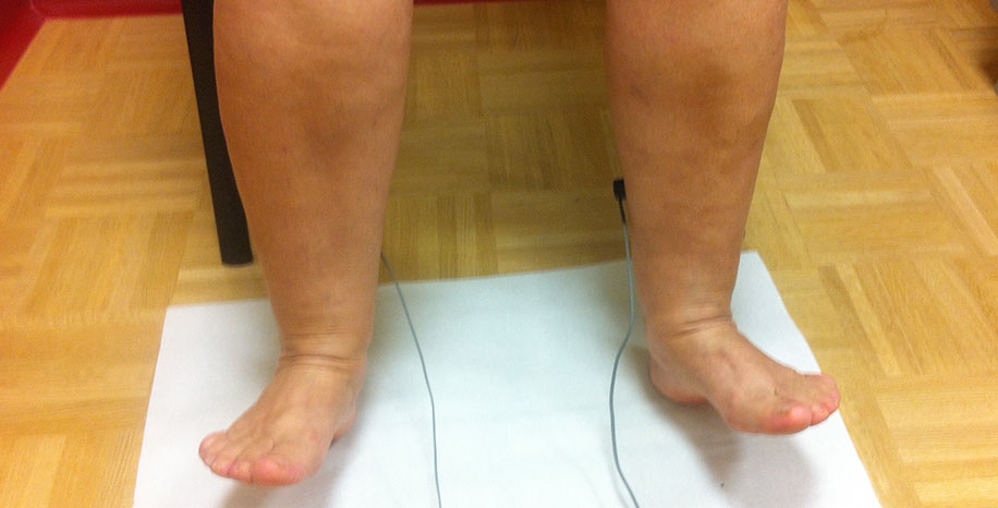 Fotopletizmografska preiskava ven