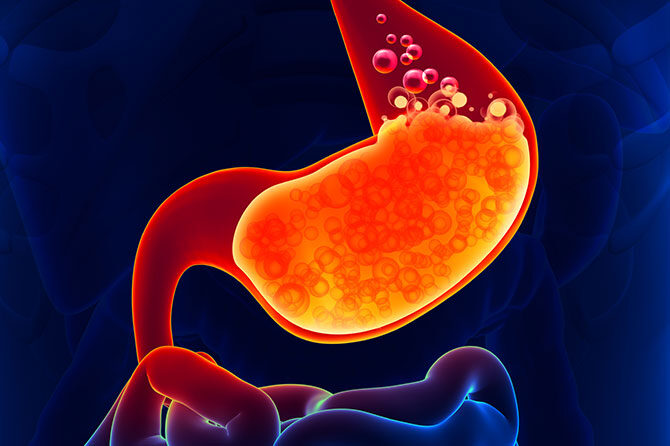 Razjeda želodca in dvanajstnika