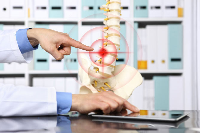 Bolečine v hrbtu – Gibanje je za zdravo hrbtenico izjemnega pomena