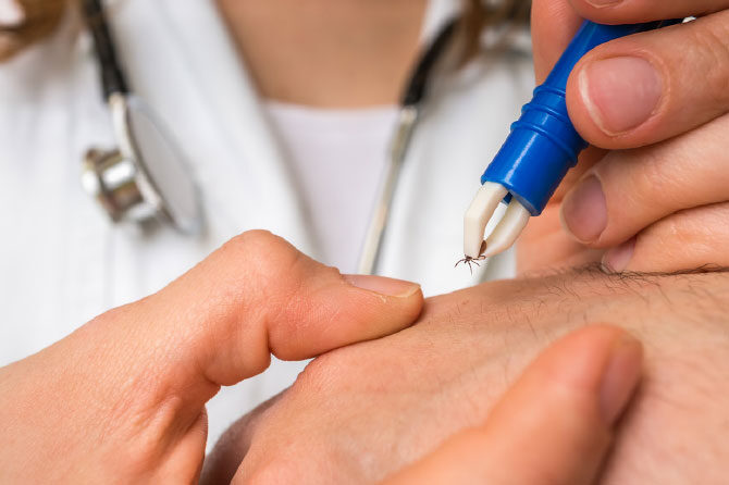 Klopi – Tri zoprne bolezni, ki jih prenašajo te potuhnjene pršice