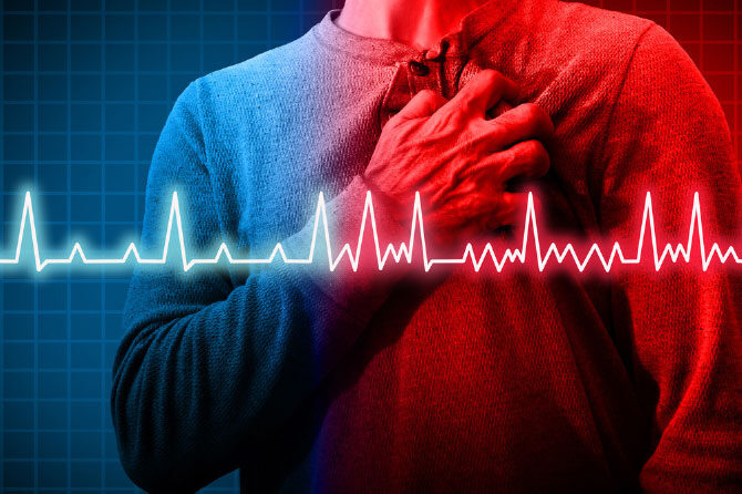 Motnje srčnega ritma – Črpalka včasih zapoje malce po svoje