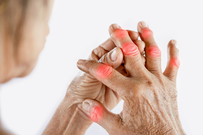 Ko nas bolijo sklepi, najbolj pomaga gibanje