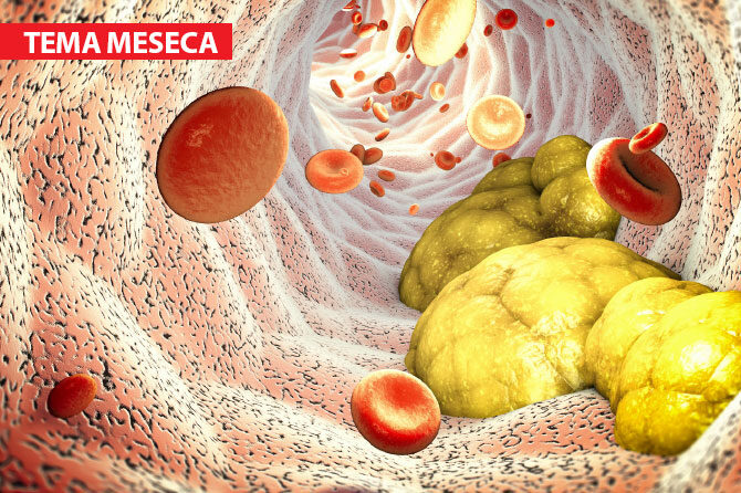 Ne bolijo, vendar nas precej skrbijo