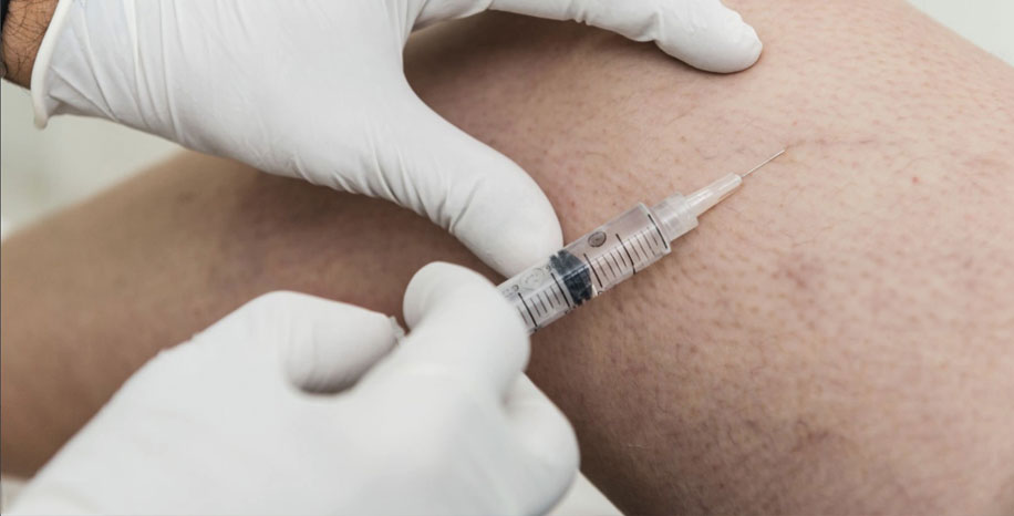 Skleroterapija ali sklerozacija ven